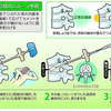 骨粗しょう症のバルーン手術