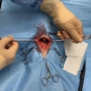 犬の胆嚢摘出手術