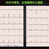 ECG-198：50才代男性。左気胸で、胸が切ないんです。