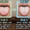 〘舌診〙：一例として気虚体質の方の舌の特徴とは？