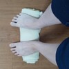 捻挫から腓骨筋腱炎と痛み過敏症(CRPS)  リハビリ4回目 ⑥