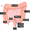 大腸がん＜基礎編＞