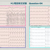 ECG-379：胸部誘導のST上昇 #心電図検定試験　Question-4