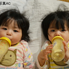 子癇前症はビタミンD摂取で高血圧リスクを低減？アメリカ・研究