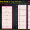 ECG-360：answer その1 = 心電図検定試験：傾向と対策 Q.008 =