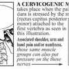 Cervicogenic Headache (頚性頭痛)