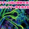スタチンは脳神経のミエリンを溶かし、アルツハイマー病を引き起こす