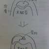 膝蓋骨脱臼骨折の記録5 ＜処置1＞