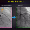 ECG-219：answer