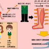 フォンタン患者の足に圧力をかける装置（ズボン）の効果