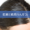 乾癬と鱗屑(りんせつ)│原因・対策・オススメクリームをご紹介