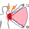 野球肩「インターナルインピンジメント」の症状と原因　ストレッチ整体で予防対策！