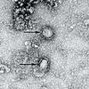 クルーズ船を除き、確認された1日の感染者数最多