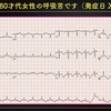 ECG-308：answer(1/2)