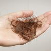 Some Of The Major Causes Of Hair Loss