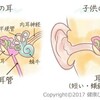 急性中耳炎から内耳炎になる…