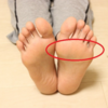 足の裏が痛くて整形外科に行く