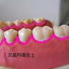 歯周病で全ての歯を失ってしまう、危険な言葉。「ずっとこの磨き方だけど、今、健康」。