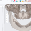 BlueSkyPlanの最新アップデート　歯と歯槽骨のセグメンテーションがAIで自動化！しかも無料！