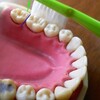 隙間に滑り込ませる、小さく歯ブラシを動かすコツ