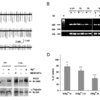 Mechanism of Activity-Dependent Downregulation of the Neuron-Specific K-Cl Cotransporter KCC2