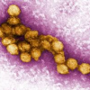 West Nile fever、西ナイル熱West Nile virus