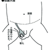 vs陰嚢水腫