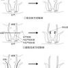 直腸がん、改めて大変な手術後だとおもう