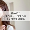 初めてのエラボトックスから1ヶ月半経過後。効果や副作用は？