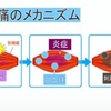 筋肉痛が