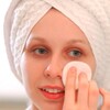 10 Unusual Tips For Reducing Acne Scars Completely