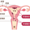 妊活中の人に伝えておきたいこと。子宮頸がん検診で高度異形成発覚→手術した私の記録①