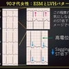 ECG-230：answer