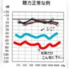 中耳炎から内耳炎になる②