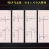 ECG-296：answer