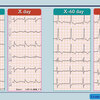 ECG-375：呼吸不全の症例 case-C question