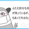 もしかして眼瞼下垂④結果は意外？にもそっち