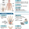 手・指のしびれ   骨の変形などで神経圧迫