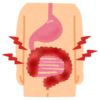 大腸CT検査　【体験談】〜当日までの準備・食事〜