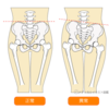 骨盤のゆがみが気になる方へ