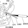 前立腺生検術を受ける