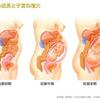 【18w4d】子宮拡大による「妊婦の胃袋圧迫ペチャンコ化現象」について