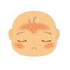 赤ちゃんのあせもの原因は？予防方法とは？