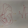 心拍数の解釈