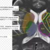 脳解剖断面memo：放線冠〜内包、基底核、脳室、PICA/AICA