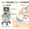 看護師さんによる在宅医療におけるエコーを科学する⑦～エコー検査装置とプローブの基礎知識