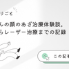 【産後の困りごと】赤ちゃんの顔のあざ治療体験談。受診からレーザー治療までの記録