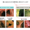 糖と油を過剰摂取するとこんな腸内環境になります