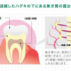 虫歯🦷じゃ無いのに歯が痛い^ ^（竿休め20230805)