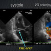 ECG-128：answer